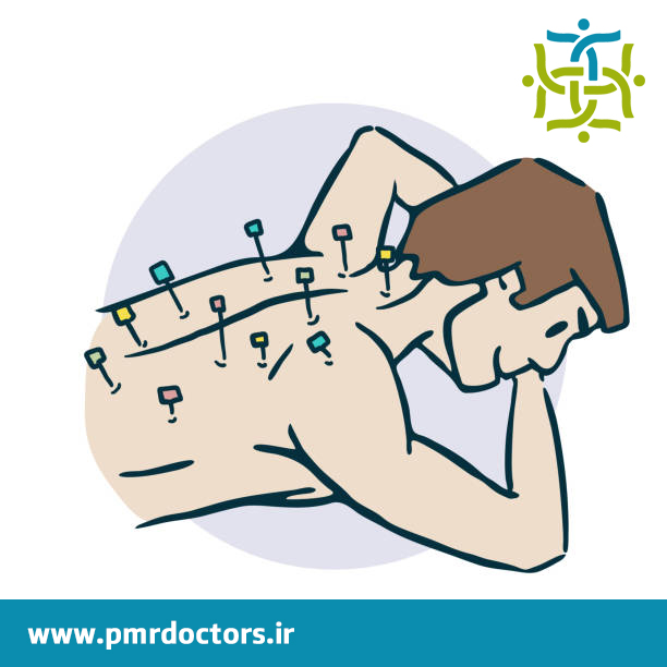 کاربرد طب سوزنی در طب فیزیکی و توانبخشی - نقش طب سوزنی در درمان