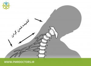 خستگی عضلات گردن و آسیب به برنر