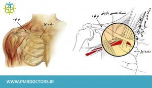ساختار بازو و شانه قبل از آسیب برنر و استینگر
