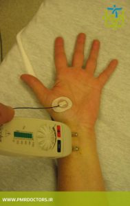 بررسی عصب دست با الکترومیوگرام - تونل کارپ