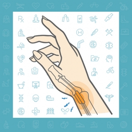 تنوسینوویت دکرون ، علتی برای درد شست