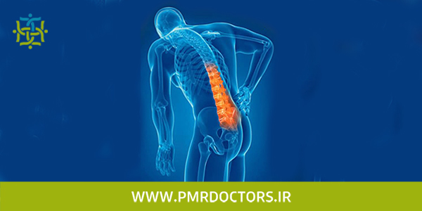 تزریق اپیدورال برای درمان بیرون زدگی دیسک کمر