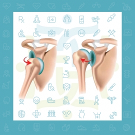 دررفتگی مکرر شانه