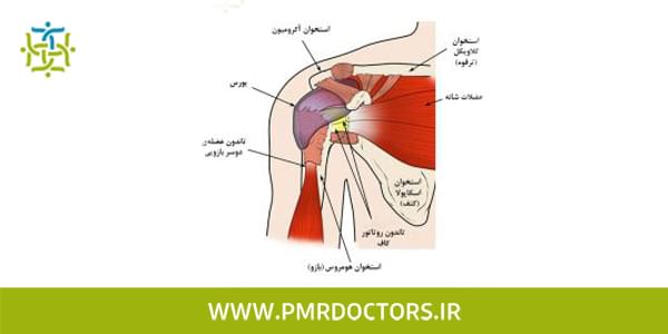 آسیب تاندونی عضله دوسربازویی