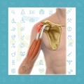 درد جلو شانه ناشی از آسیب، پارگی و التهاب تاندون عضله دوسربازویی (عضله بای سپس-Biceps)