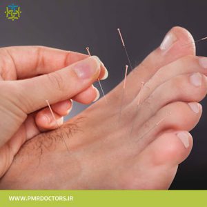 طب-سوزنی-گروه-تخصصی-پزشکان-طب-فیزیکی-و-توانبخشی