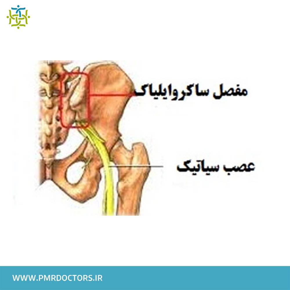 درد مفصل