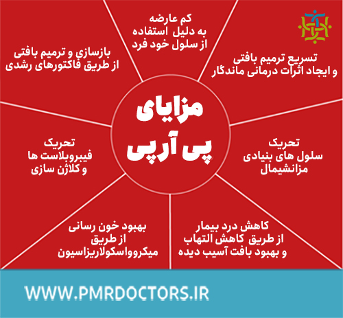 مزایای انجام پی آر پی PRP با عوارض کم