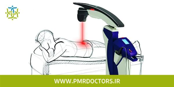 درمان بدون جراحی دیسک کمر با لیزر پرتوان