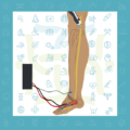 نوار عصب و عضله پا و کمر در دیسک و سیاتیک