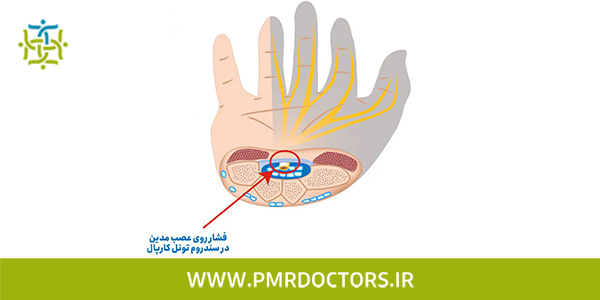 آزمایش عصب و عضله