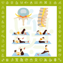 تنگی کانال نخاعی کمر و علائم آن چیست؟ 24 ورزش اصولی درمان