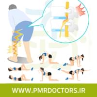 فتق دیسک کمر و درمان بیرون زدگی آن با بهترین تمرینات ورزشی