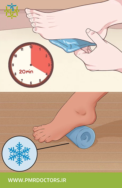 استفاده از یخ برای کم کردن درد پاشنه پا و خار پاشنه
